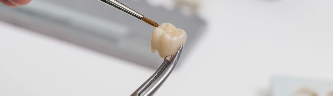 A person holding a crown with a pair of plyers.