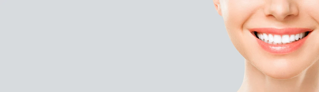 A woman smiling with perfect teeth.